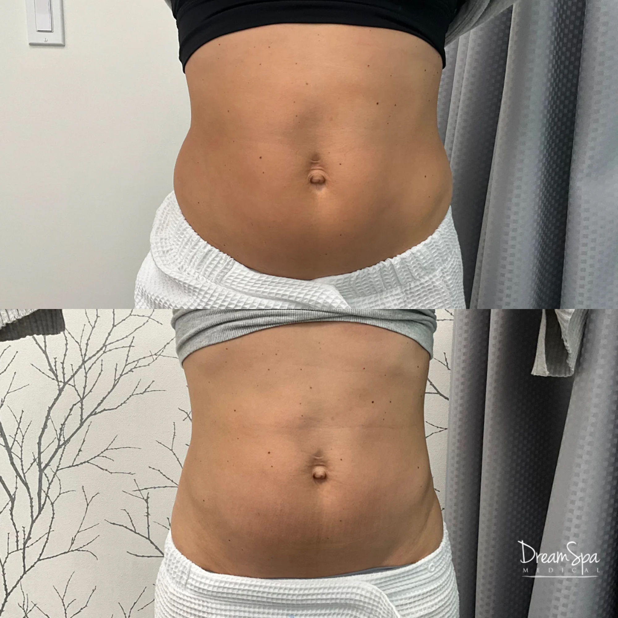 semaglutide training for nurse practitioners Medical Weight Loss Training Certification